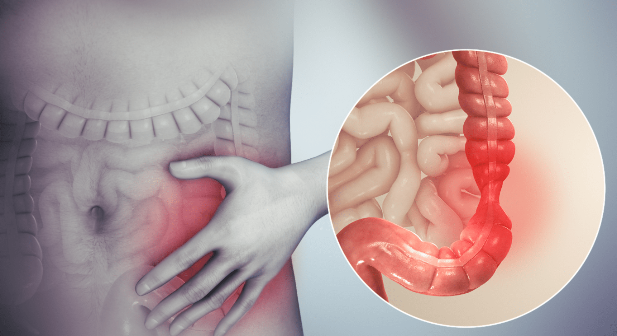 IBS Pain Problems Without Red Light Therapy