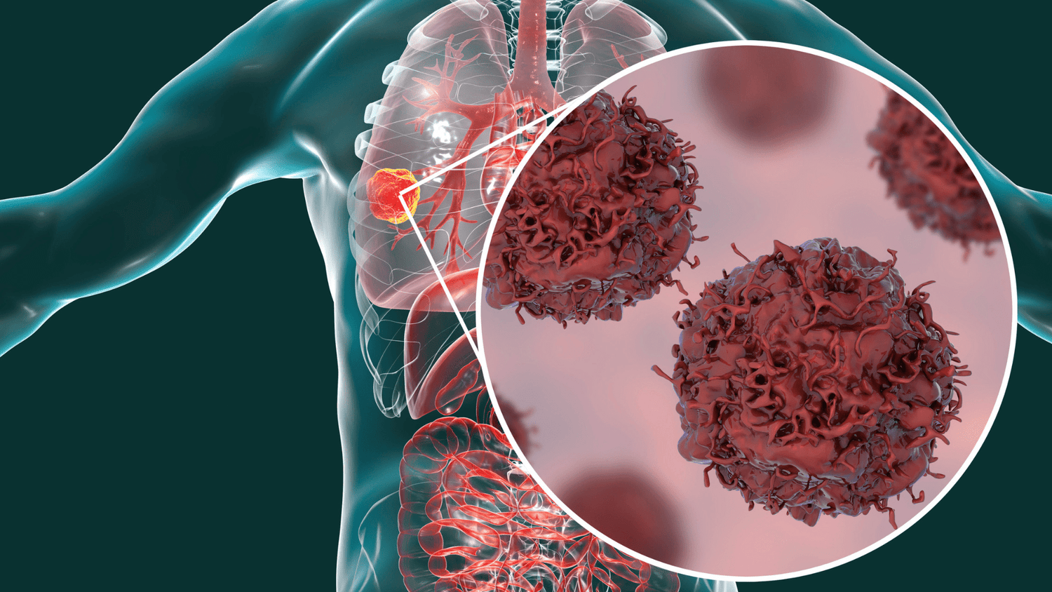 Can Red Light Therapy Cause Cancer? Can Red Light Therapy Cause Cancer Cells to Grow?