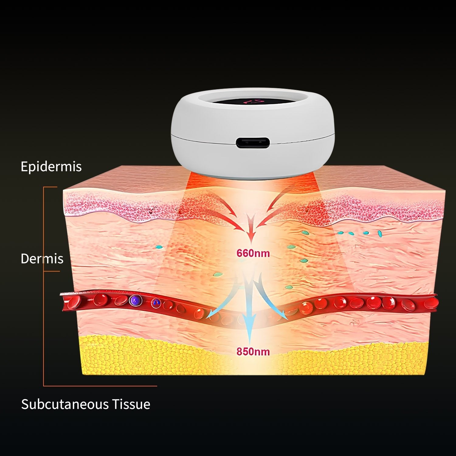 NoMore® Pain - Wearable Device