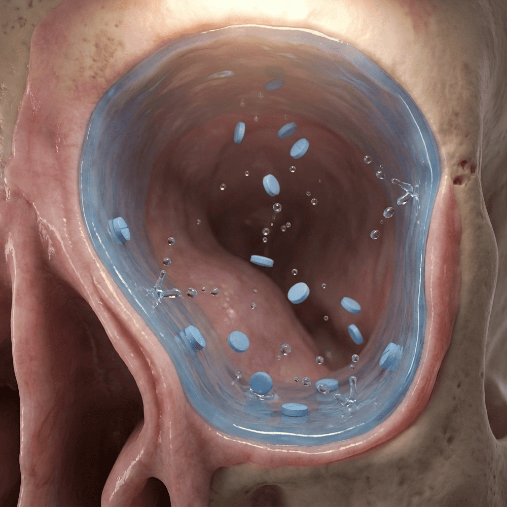 It treats the bacteria your sprays and antibiotics can't reach